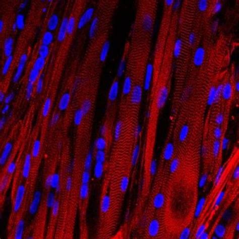 Breakthrough Research Bioengineered Human Muscle That Contracts Like