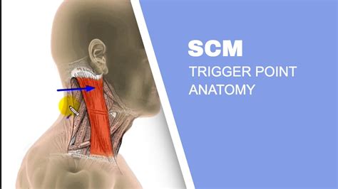 Sternocleidomastoid Muscle Scm Trigger Points Youtube
