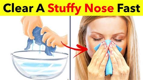 5 Simple Ways To Clear A Stuffy Nose Instantly How To Get Rid Of Nasal Congestion Youtube
