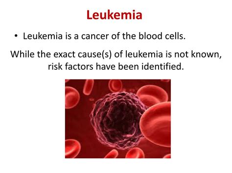 Ppt Leukemia Powerpoint Presentation Free Download Id2031670