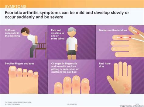 Psoriatic Arthritis Symptoms Causes Treatment And More