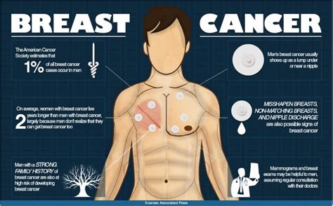 This higher mortality rate has been attributed to less awareness of male breast cancer and slower recognition of cancer symptoms, which can. Male Breast Cancer