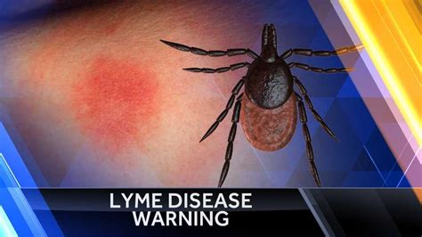 Early Detection Vital For Lyme Disease