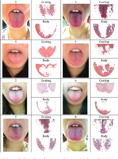 Figure 6 From Tonguedx A Tongue Diagnosis System For Personal Health