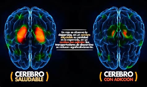 ¿cómo Afectan Las Drogas Al Cerebro Erbol Digital Archivo