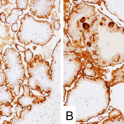 Mesothelin Expression In Normal Tissues A And B Mn 1 Antibodies