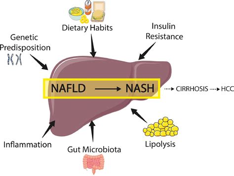 Increased Risk Of Acute Liver Failure By Pain Killer Drugs In Nafld
