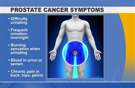 What Is Prostate Cancer Signs And Symptoms Health Ideas