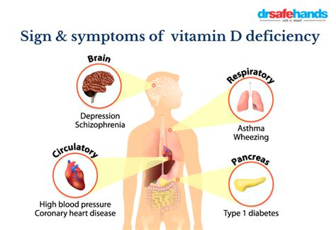 Signs And Symptoms Of Vitamin D Deficiency Drsafehands
