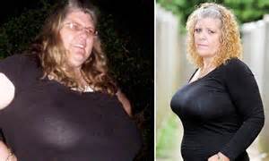 Mother Who Had M Size Chest Is Refused Nhs Breast Reduction Op Despite Losing St Daily Mail