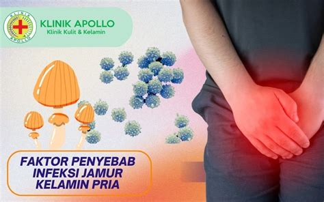 Cara Mengobati Infeksi Jamur Pada Kelamin Pria Klinik Apollo