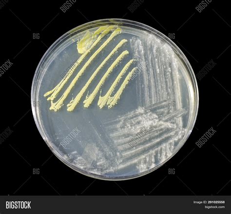 Growth Bacteria Fungi Image And Photo Free Trial Bigstock