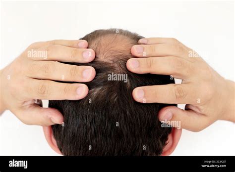 Bald Man Back Of Head Hi Res Stock Photography And Images Alamy
