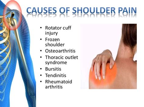 Shoulder Pain Cobram Physio