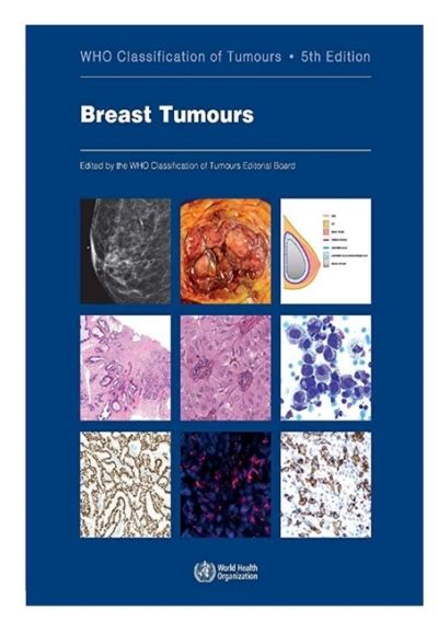 Pdf Free Download Defaultset Breast Tumours Who Classification Of