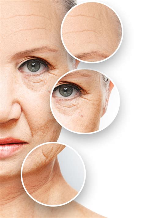 Fine Lines And Wrinkles Hair And Skin Science