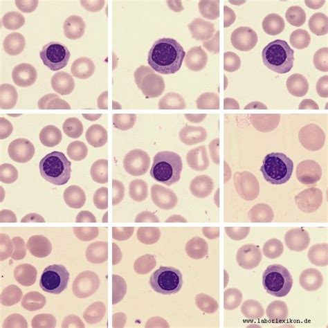 Nucleated Red Blood Cells Nrbcs Medical Technology Medical