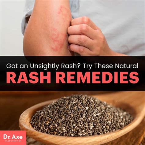 How To Get Rid Of A Rash 6 Natural Rash Remedies Dr Axe