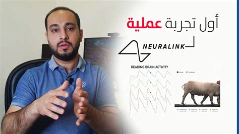 أمطار ورعد وبرق وكرات ثلج. زراعة اول شريحة الكترونية في الدماغ - ايلون ماسك - YouTube