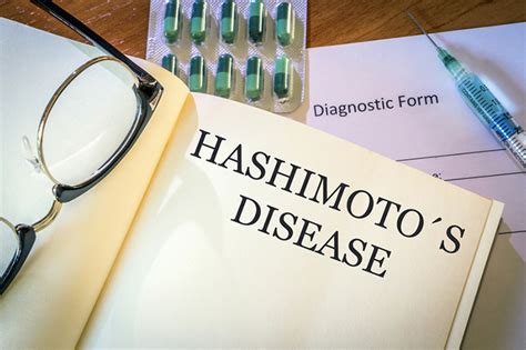 What Is Hashimotos Disease University Health News