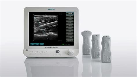 The 3 Core Benefits Of Ultrasound Systems For Bedside Imaging