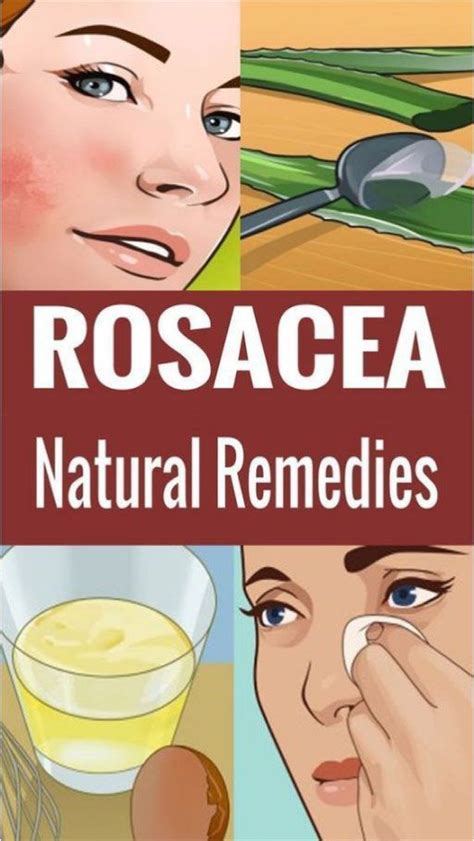 Natural Home Remedies Against Rosacea That Might Help You Home