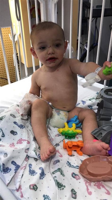 Mom Warns Others After 1 Year Old Tests Positive For Herpes Virus Fox
