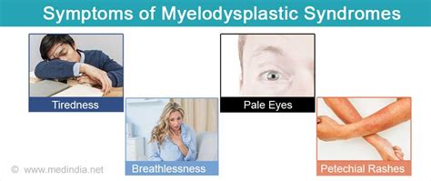 Myelodysplastic Syndrome Types Causes Symptoms Diagnosis