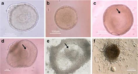 Representative Photographs Of Mouse Preantral Follicles From 14 Day
