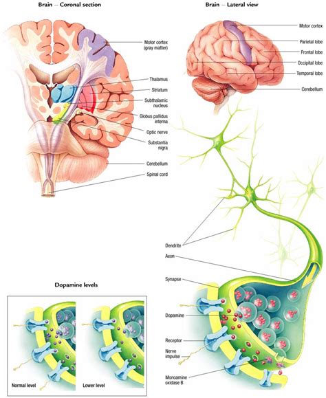 Feb 23, 2017 · the pathophysiology of parkinson's disease (pd) is only partially understood, although considerable progress has been made. Parkinson's disease - Atlas of pathophysiology, 2 Edition