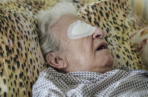 Flashing Lights In Eye After Cataract Surgery Shelly Lighting