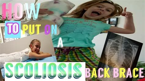 How To Put On Your Scoliosis Brace The Right Way Youtube