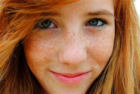 Jb Teen Girls With Freckles Telegraph
