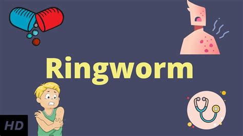 Ringworm Causes Signs And Symptoms Diagnosis And Treatment Youtube