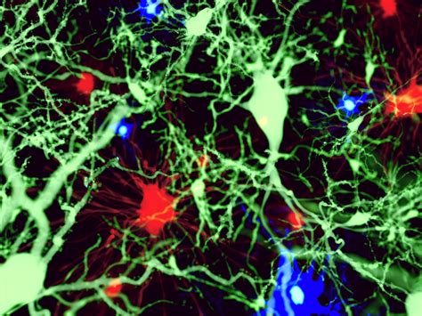 Autism Brainnetnew Insights Into The Function Of Microglia A Type Of
