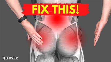 How To Fix Muscle Knots In Your Lower Back And Hips YouTube