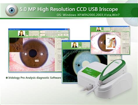 5 0 MP USB IRISCOPE Iridology Camera Iris Analyzer Iris Diagnosis Skin