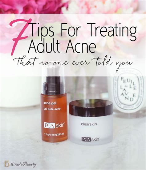 Tips For Treating Adult Acne That No One Ever Told You With Images Treating Adult Acne