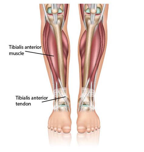 On the side of the foot are. Ankle Tendonitis | Anterior Tibial Tendonitis