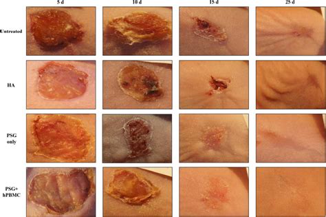 Gross Morphology Of Wound Healing Of A Full Thickness Cutaneous Wound