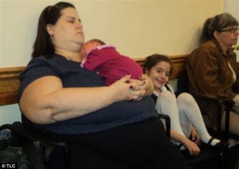 Obese Women Giving Birth