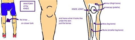 Knee Broken Knee Tibial Plateau Fracture — Bone Talks