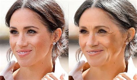 Meghan Markle Plastic Surgery Nose Job Teeth Before And After In