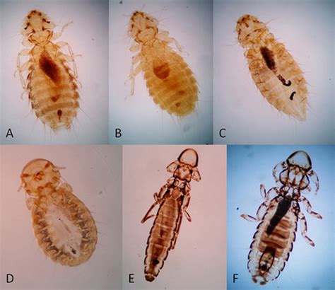 How To Identify Treat And Prevent Chicken Lice