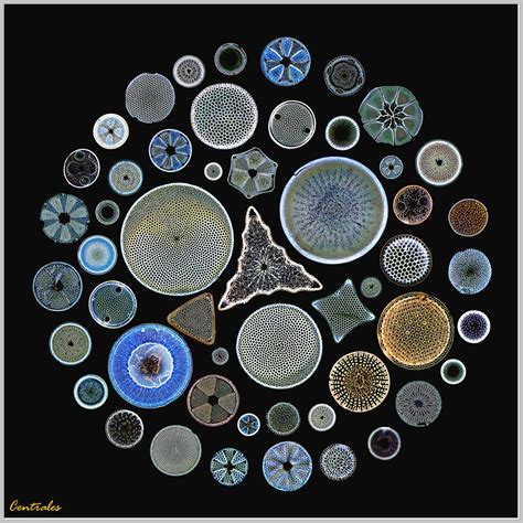 Rosette Centrales G Kreispraeparat Picture Of Diatom Microscopic