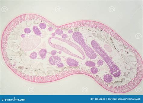 Parasitic Nematode Worm Ascaris Sp Under The Microscope Stock Photo