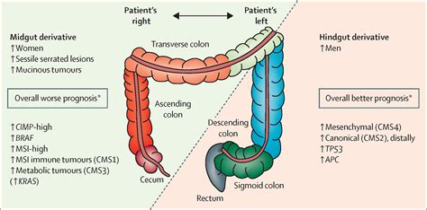 Colonic Pathology Large Intestine Olorectal Lesion Model Intestinal Disease Colonic Lesion