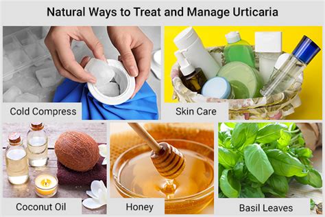 Manage Urticaria 5 Natural Ways And 7 Self Care Tips