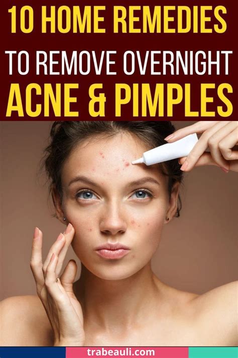 How To Get Rid Of Acne Overnight Diys That Actually Work Artofit