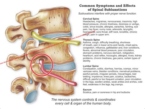 Common Effects Of Spinal Subluxation Poster